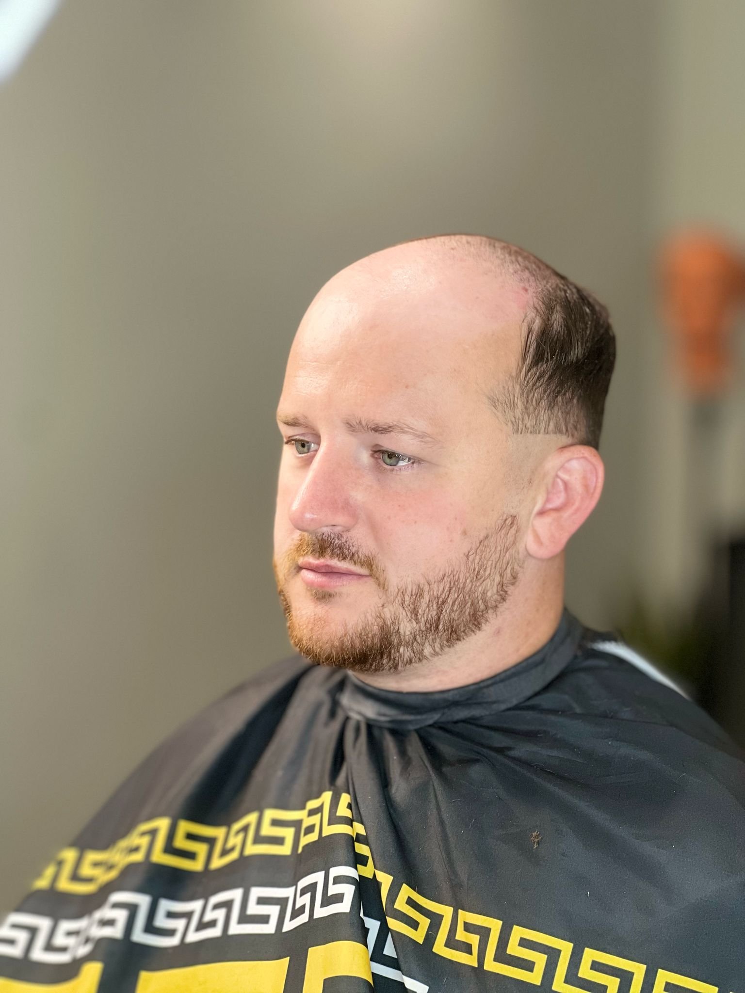 Hairclub MK portfolio 14