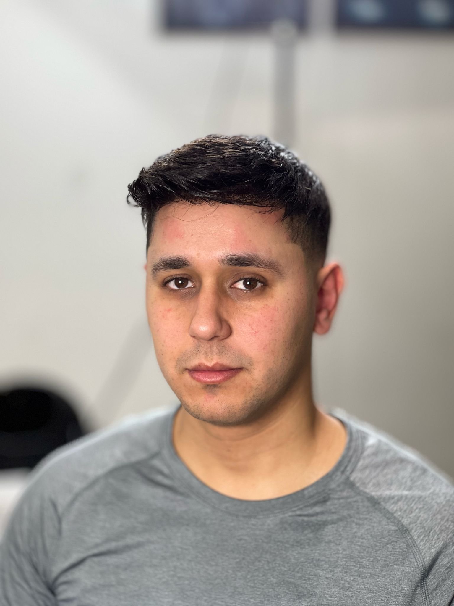 Hairclub MK portfolio 24